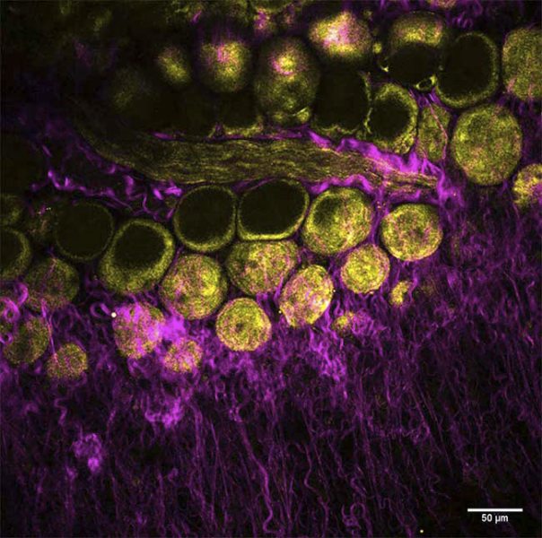 Mouse mammary gland, label free image of collagen (SHG, magenta) and adipocytes (THG, yellow)