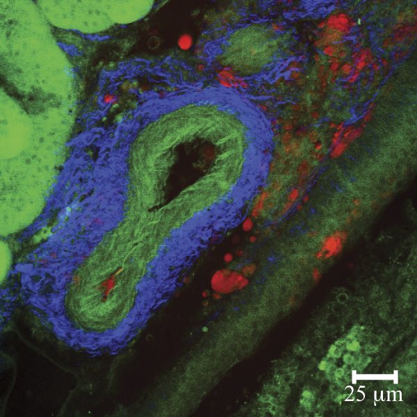 Mouse kidney, with CARS (red), SHG (blue) and autofluorescence (green)