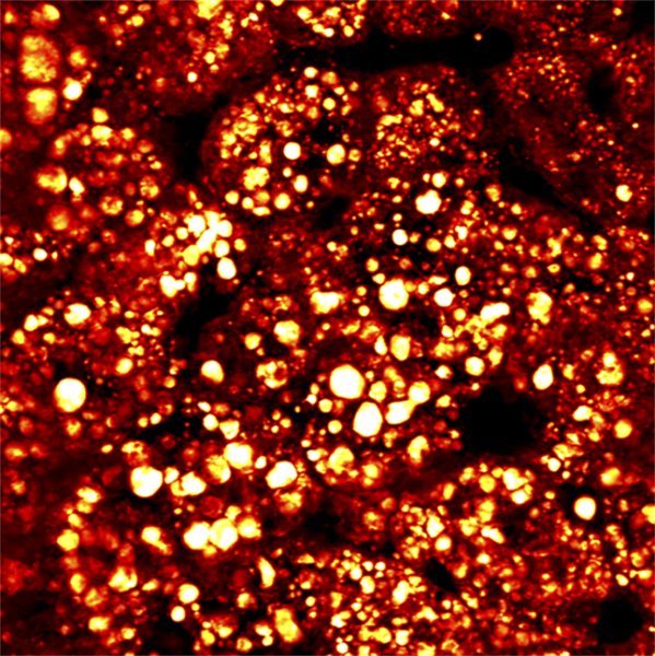 SRS image of fatty liver, pump 802 nm and Stokes at 1040 nm.