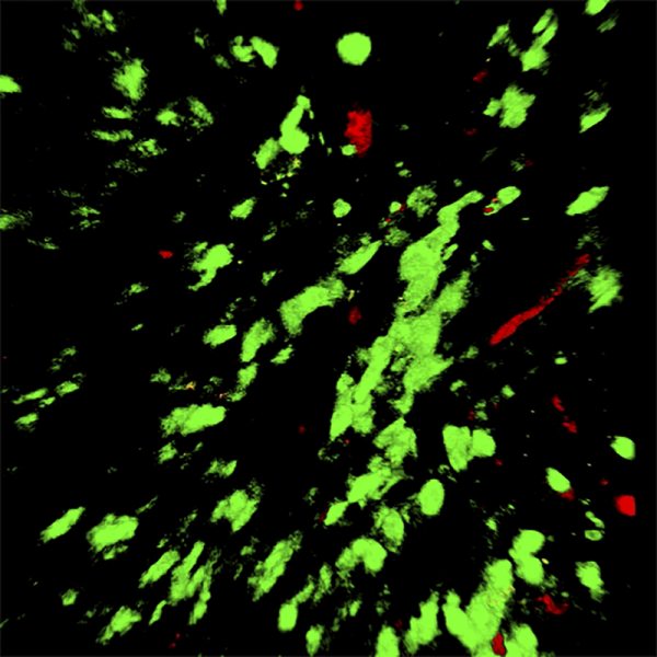 Continuous tracking of T cells and dendritic cells 