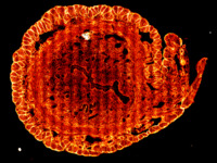 SRS - stimulated raman scattering bio-imaging example