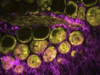 THG - third harmonic generation bio-imaging example