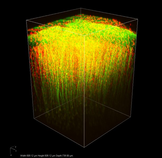 Multicolor image of live mouse brain; imaged with InSight DS+.