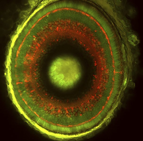 Transgenic zebrafish embryo retina, revealing various neuronal cell types